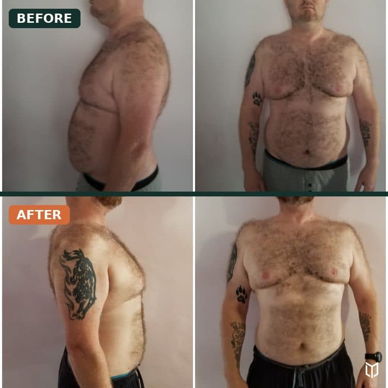 A client photographed from four angles, before and after